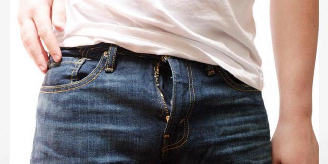 pengalaman resleting kebuka